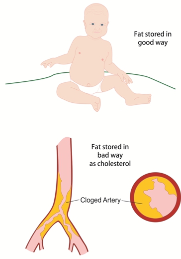 Heart Disease Is Coming To a Person Near You